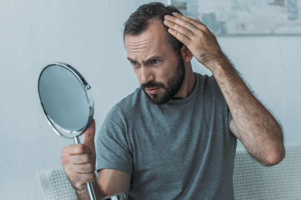 Which Hair Restoration Treatment Is Best For Me?