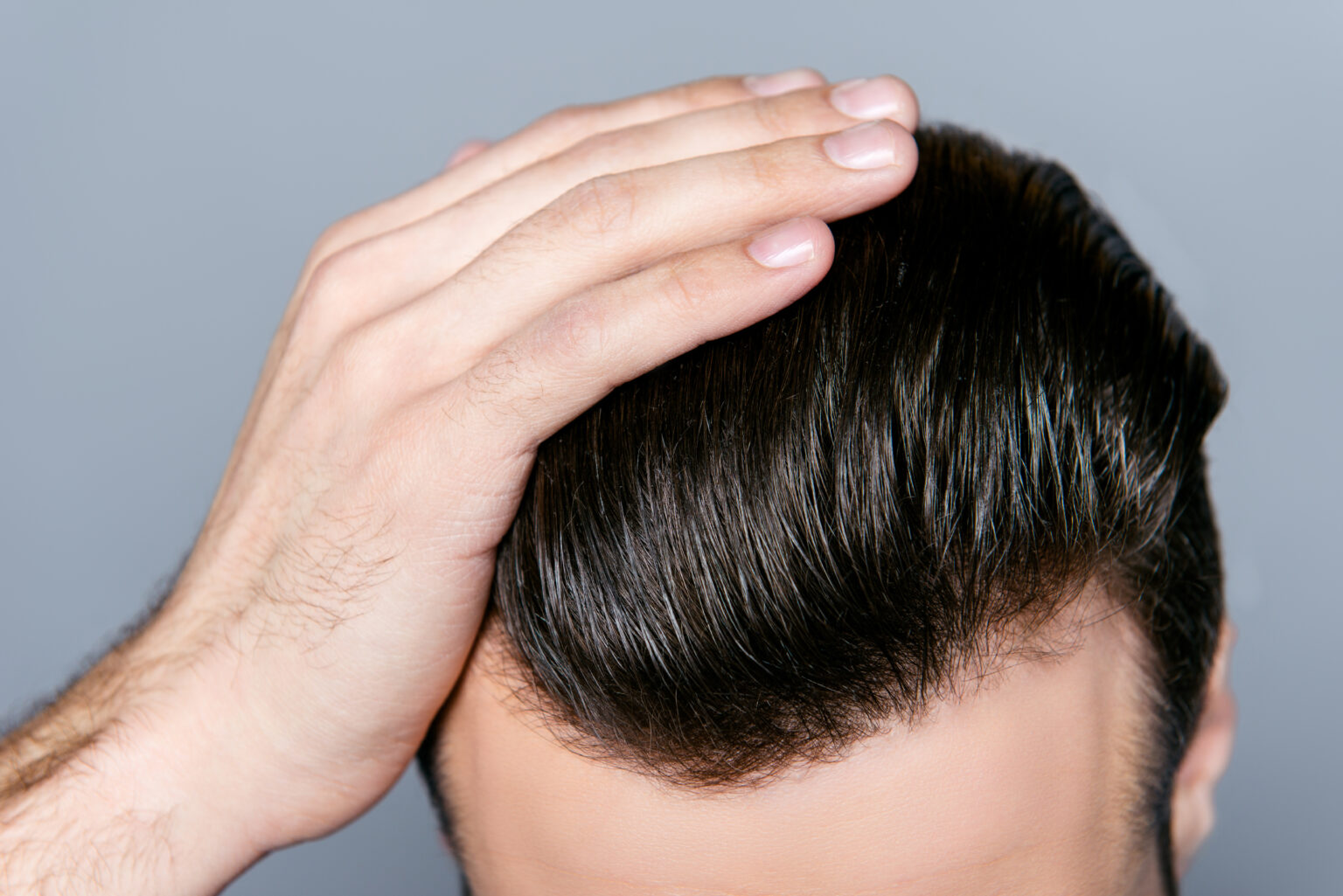 Why Does Hair Loss Occur?